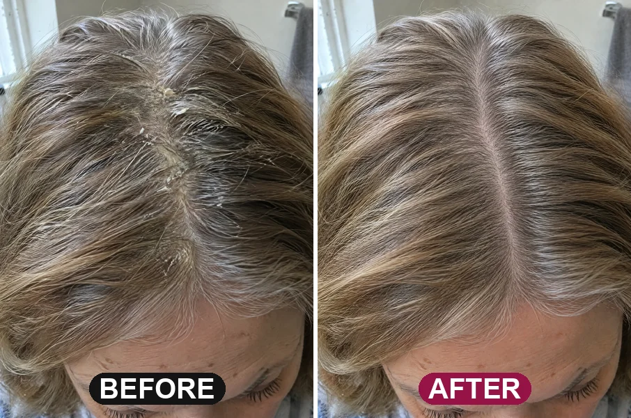 Before: a part line coated in greasy buildup and flakes. After: the same part, clean down to the scalp